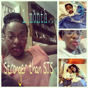 Kennitra Thomas documents her recovery from SJS.